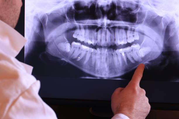 Best Emergency Treatment for Jaw Pain or Injury in Sturgis, MI
